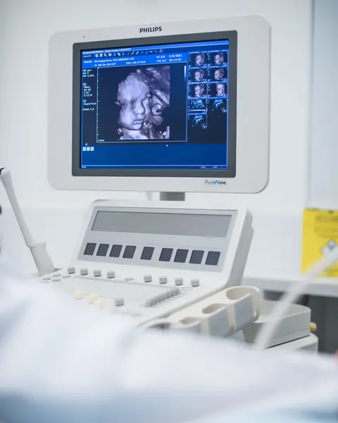 Aparelho de ultrassom da clínica mostrando a imagem 3D de um bebê